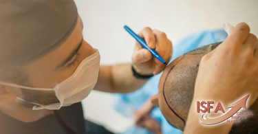 10 best hair transplant clinics indubai uae in 2024 with cost